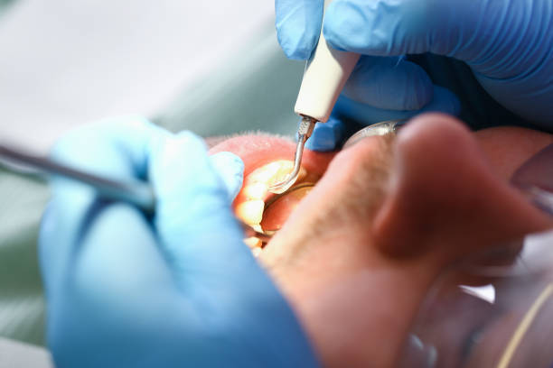 Best Pediatric Emergency Dentist in Oasis, CA